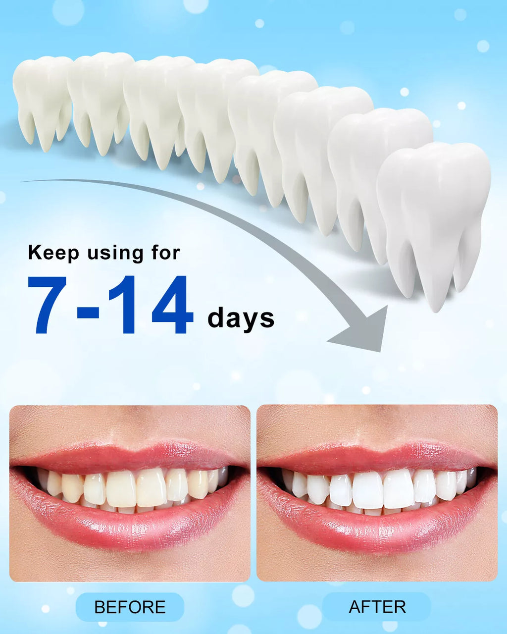 5-LED Teeth Whitening Light for Teeth Whitening Kit Accelerator with Teeth Whitening Tray Teeth Whitener, 10Min Smart Timer